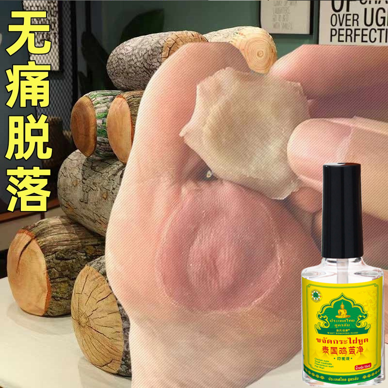 【自然脱落】老茧脚茧关节茧手茧脚底老茧厚茧鸡眼专用脚垫