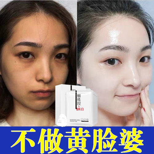 美白面膜精华液去黄气提亮肤色改善黄皮肤暗沉发黄去暗黄脸色祛黄 - 封面