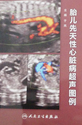 胎儿先天性心脏病超声图例