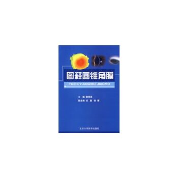 图释圆锥角膜