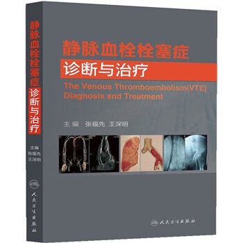 静脉血栓栓塞症诊断与治疗(包销300)