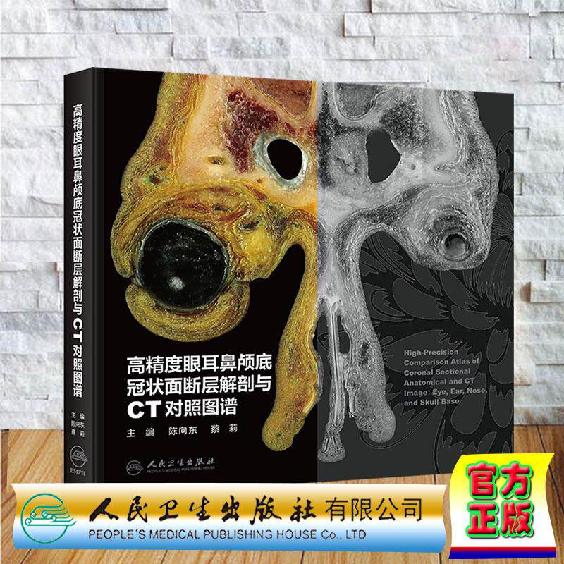 高精度眼耳鼻颅底冠状面断层解剖与CT对照图谱 陈向东 蔡莉 精装 人民卫生出版社9787117389396