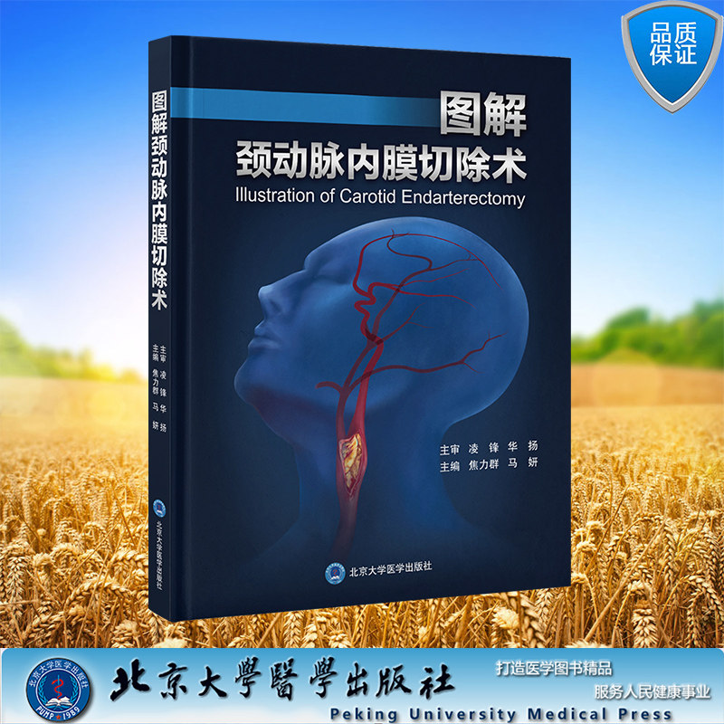 现货正版  图解颈动脉内膜切除术 焦力群 马妍 主编 北京大学医学出版社 9787565927652