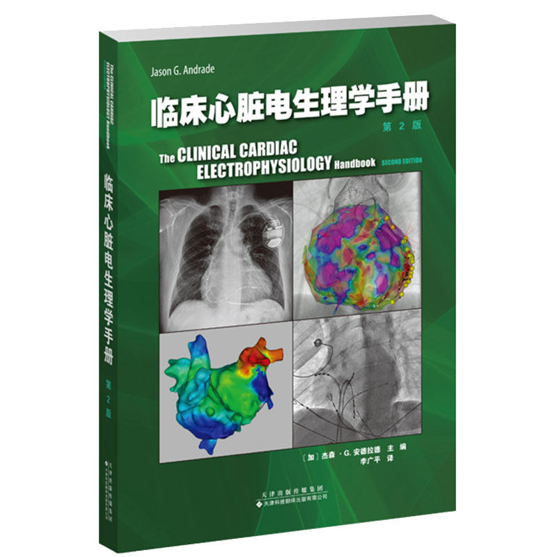 现货临床心脏电生理学手册 第2版 李广平译 心律失常识别诊断管理 临床电生理 心脏疾病天津科技翻译出版社9787543342804
