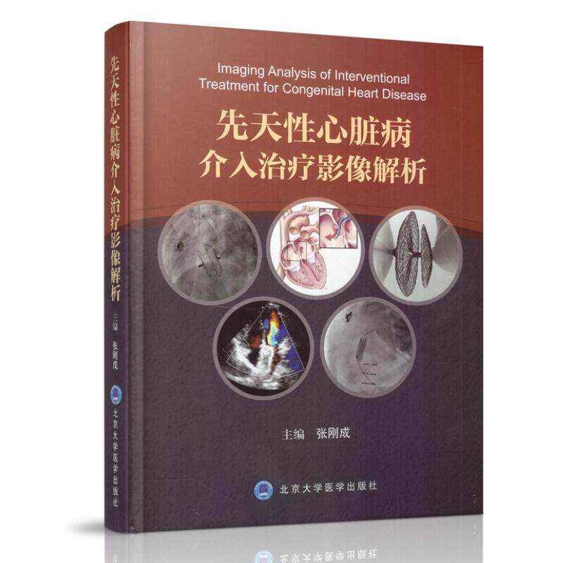 正版现货 先天性心脏病介入治疗影像解析 张刚成 主编 北京大学医学出版社