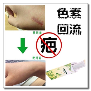 去除德国增生疤痕凸起肤蜡遮盖祛脸面部黑色素沉积美国克星修复膏