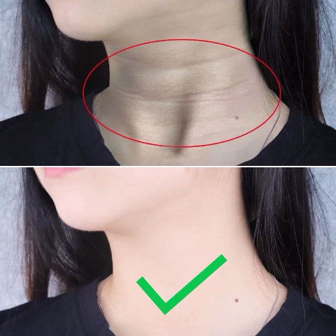 美颈霜双滚轮去淡化颈纹提拉紧致女颈部护理神器脖子颈膜