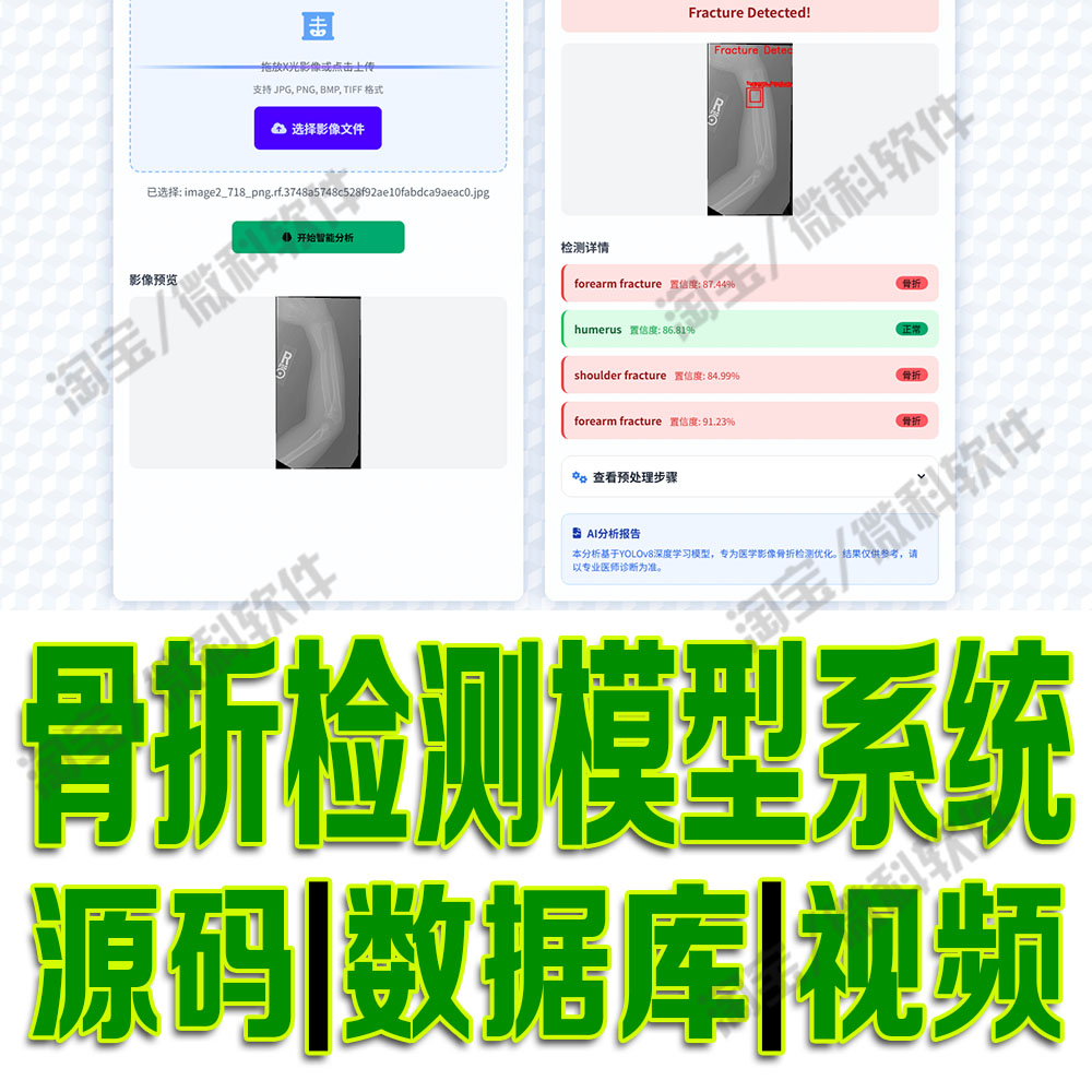 骨折部位识别检测系统yolov8模型数据分析flask深度python源码