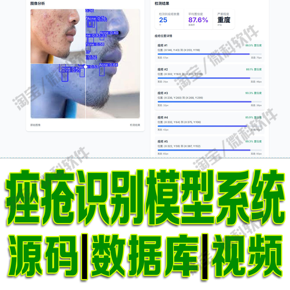 痤疮识别模型检测系统yolov8数据分析flask深度数据集python源码