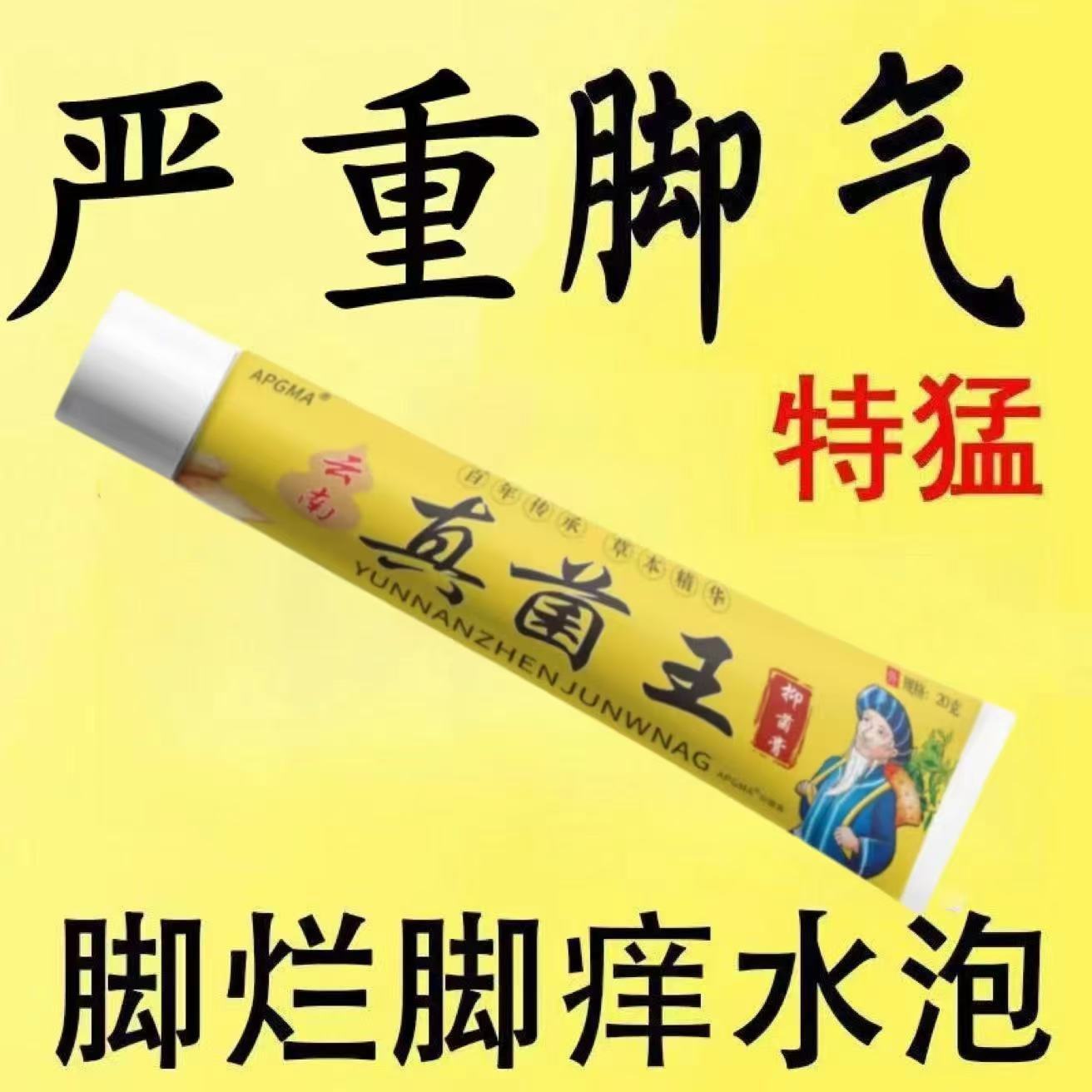 云南真菌王手上起小水泡专用汗疱疹药膏