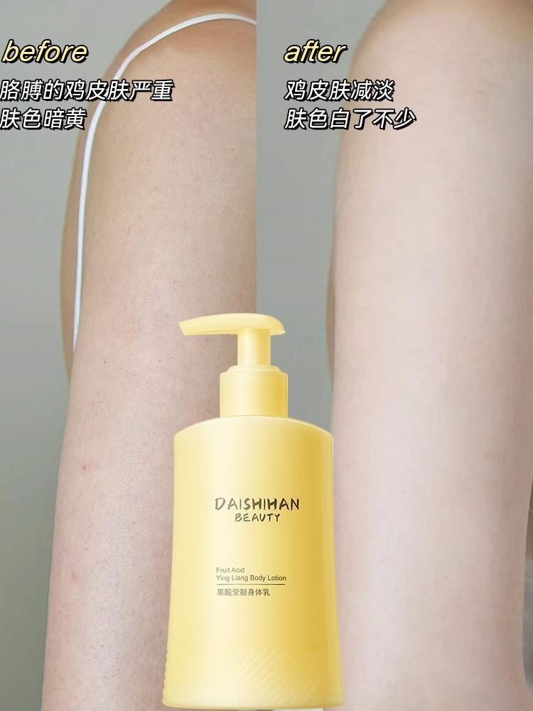 果酸沐浴乳可以去鸡皮肤吗(果酸身体乳去鸡皮肤有效果吗)