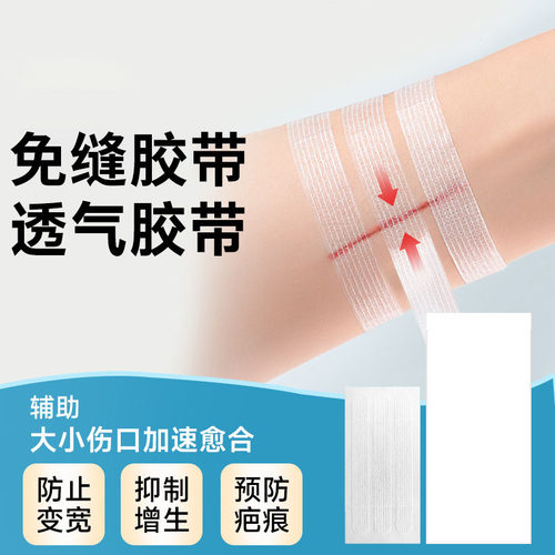 免缝胶带美容外科术后拉合胶布