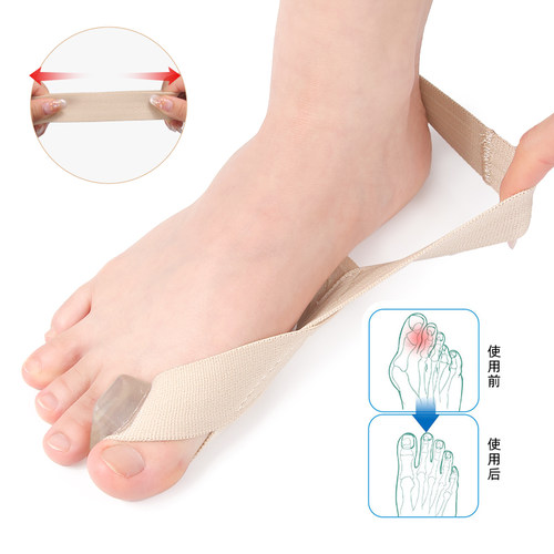 可穿鞋大拇指外翻脚趾矫正器