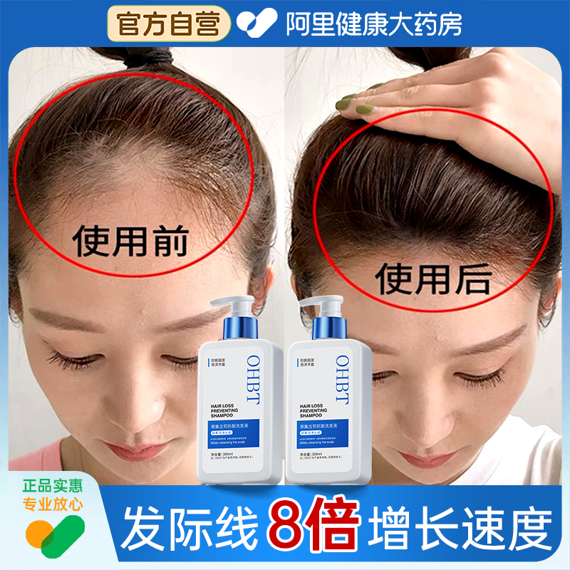 【许妍同款】防脱发洗发水第1名