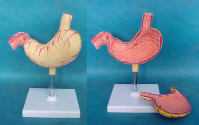 人体胃解剖(j病态)模型胃模型教学医用讲解标