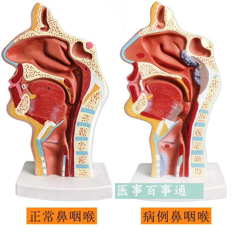 人体鼻腔 口腔 咽喉解剖模型 鼻咽腔 口咽腔 喉咽腔 耳鼻喉科模型