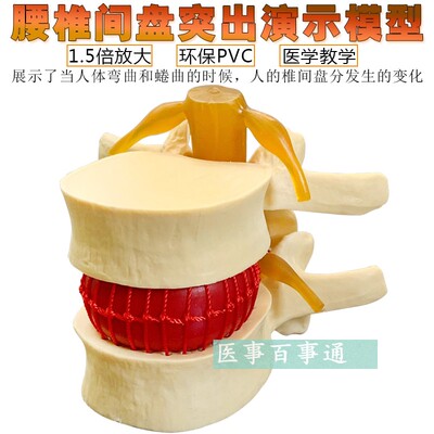 脊柱模型脊椎骨头腰椎间盘模具椎体模型突出受压病理骨质教具包邮