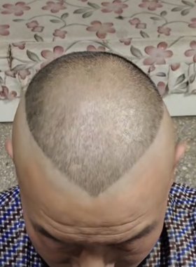郭德纲成人理发模具同款头型