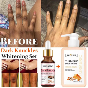 Whitening Serum Turmeric 2pcs Lotion Knuckle Body Remov Dark