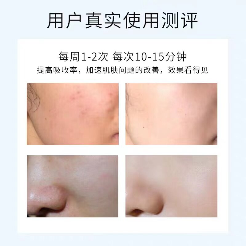 쿠폰 후 339위안 SHILUOXI 도입 장치 마이크로 바늘 나노 워터 라이트 바늘 수분 공급 미백 민감성 여드름 자국 성장 촉진