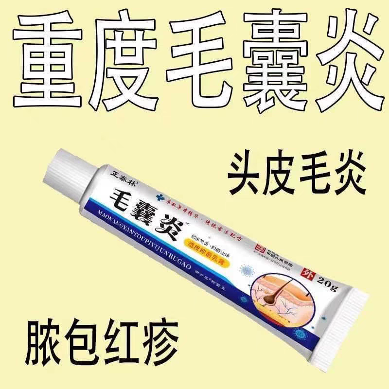 毛囊炎药膏正品头皮部脸部背部胸部毛囊痘脓包痤疮皮肤痒抑菌