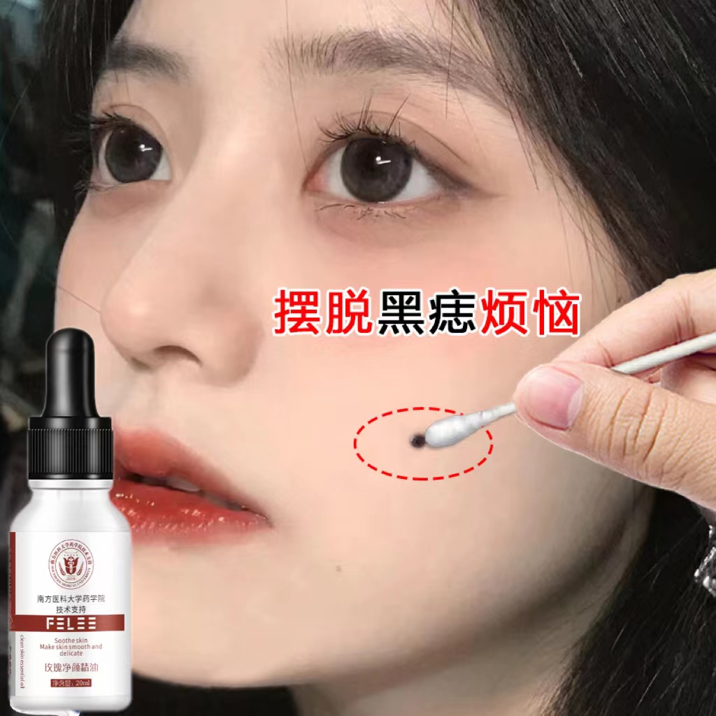 【小红书热销】去脸部各种顽固斑点斑迹 淡化脸上黑色素 男女可用