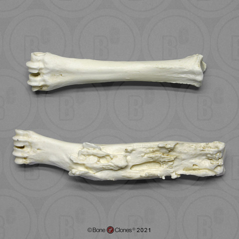 BoneClones定制科教模型