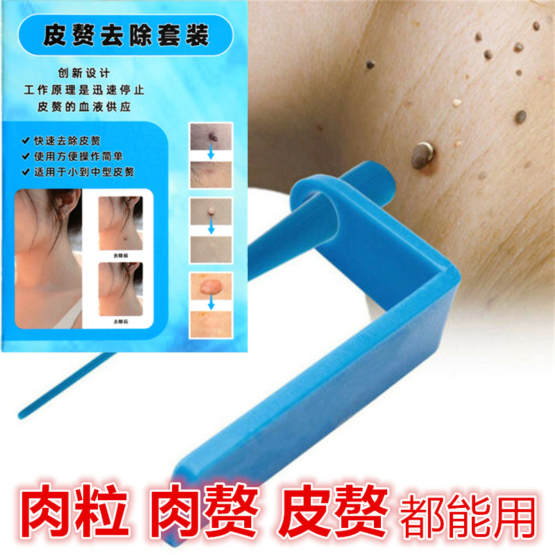 物理去小肉粒皮赘肉赘肉球工具