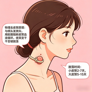 新款非药膏物理去除脖子小肉粒肉球丝状尤皮赘神器祛肉赘工具套装