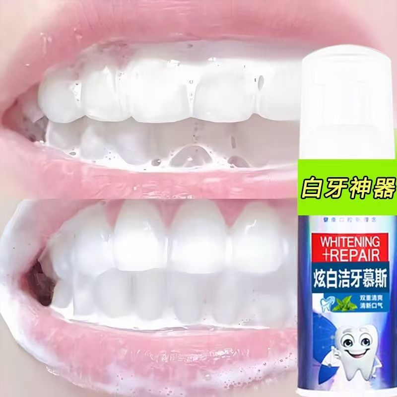不用去洗牙【刷刷白了】