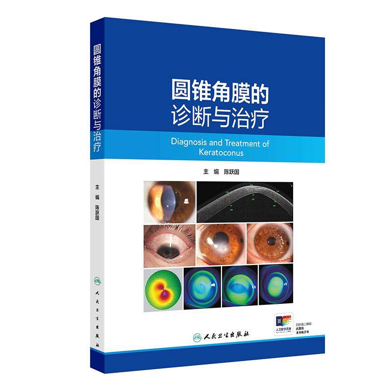 圆锥角膜的诊断与治疗 陈跃国 主编 圆锥角膜的流行病学 角膜地形图特征 供眼科医生及医学生阅读参考9787117371681人民卫生出版社