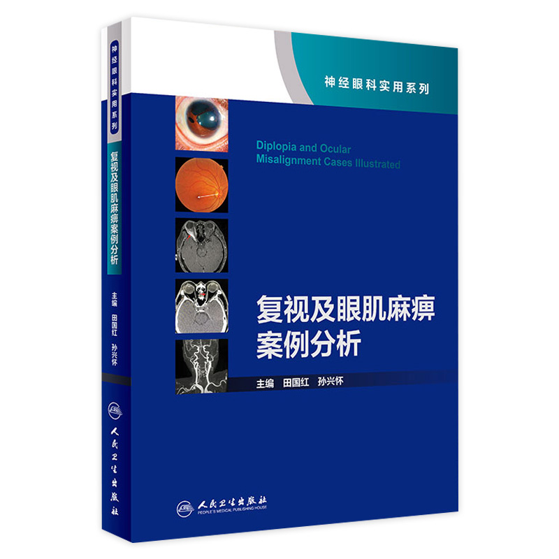 全面解读导致复视与眼肌麻痹的疾病