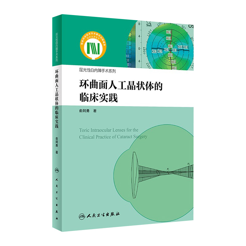 环曲面人工晶状体的临床实践 屈光性白内障手术系列 俞阿勇 著 临床典型病例分析 详细诊疗思路总结 人民卫生出版社 9787117360593