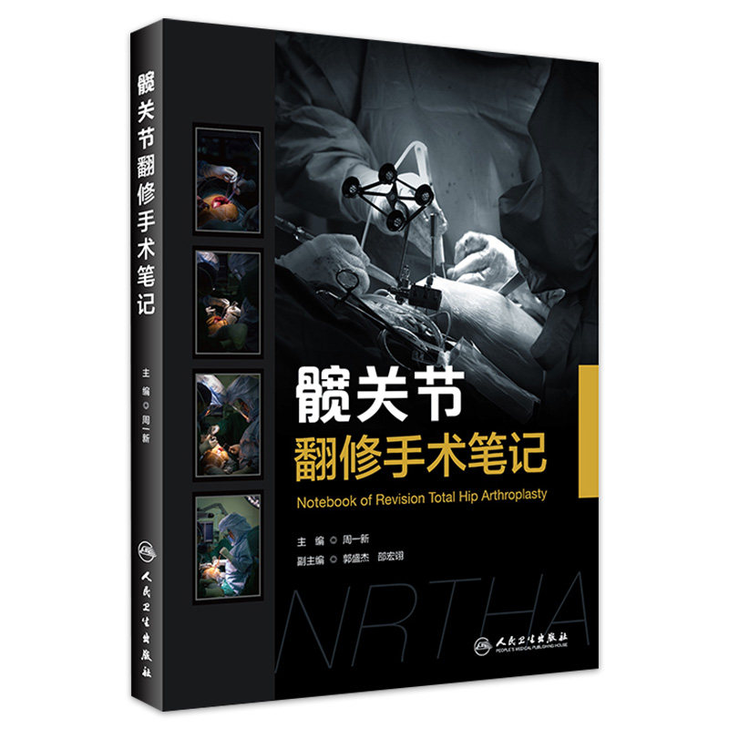 髋关节翻修手术笔记周一新 主编 外科学髋关节失败模式病例摘要术前计划手术过程术后情况机器辅助翻修 外科学人民卫生出版社