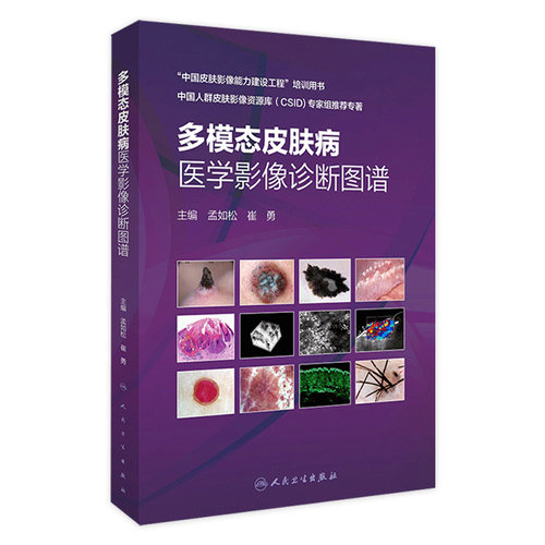 多模态皮肤病医学影像诊断图谱 皮肤高频超声影像学技术 皮肤科医生临床医学书籍 孟如松 崔勇 主编 9787117311267 人民卫生出版社