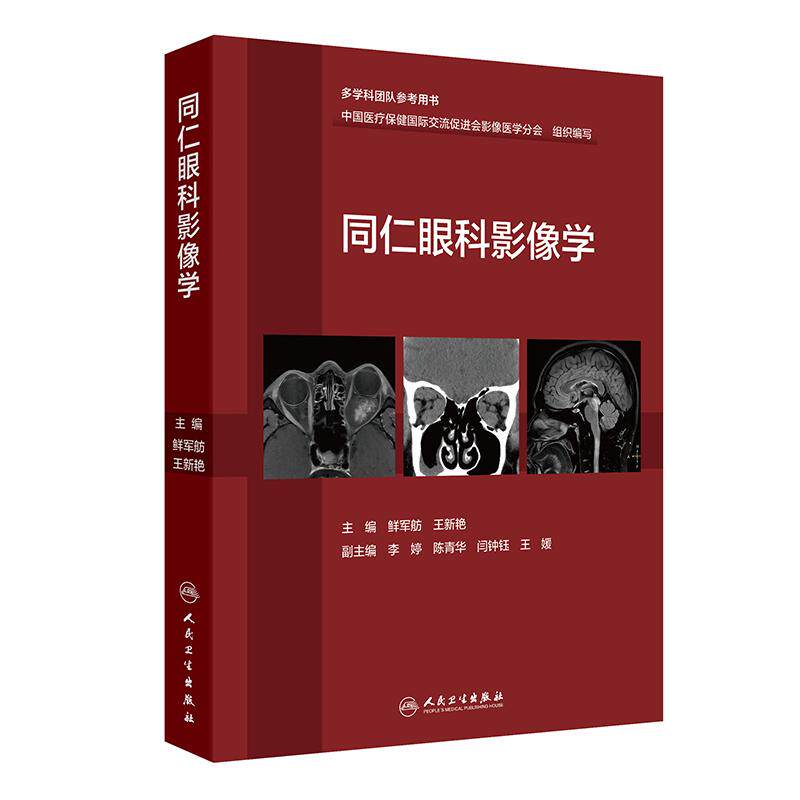 同仁眼科影像学 鲜军舫,王新艳 眼科疾病影像诊断学 基于解剖部位的眼部影像诊断与鉴别诊断 人民卫生出版社 9787117379977
