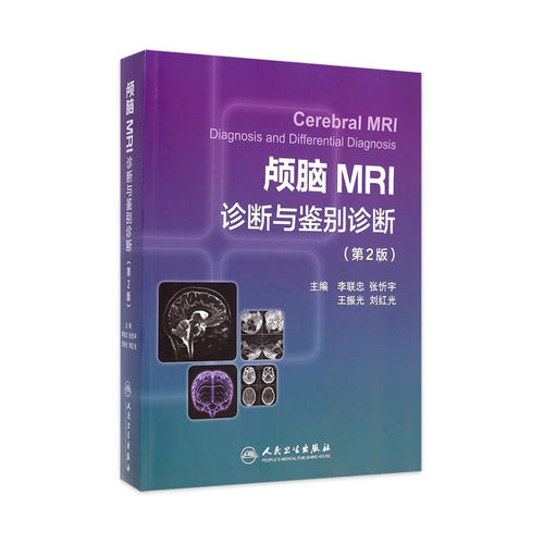 颅脑MRI诊断与鉴别诊断（第2版）李联忠 临床颅脑疾病CT图谱 磁共振核磁共振成像诊断学原理与技术 人民卫生 9787117198318