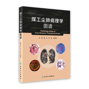煤工尘肺病理学图谱 2021年2月参考书 杨方孙影刘和亮主编