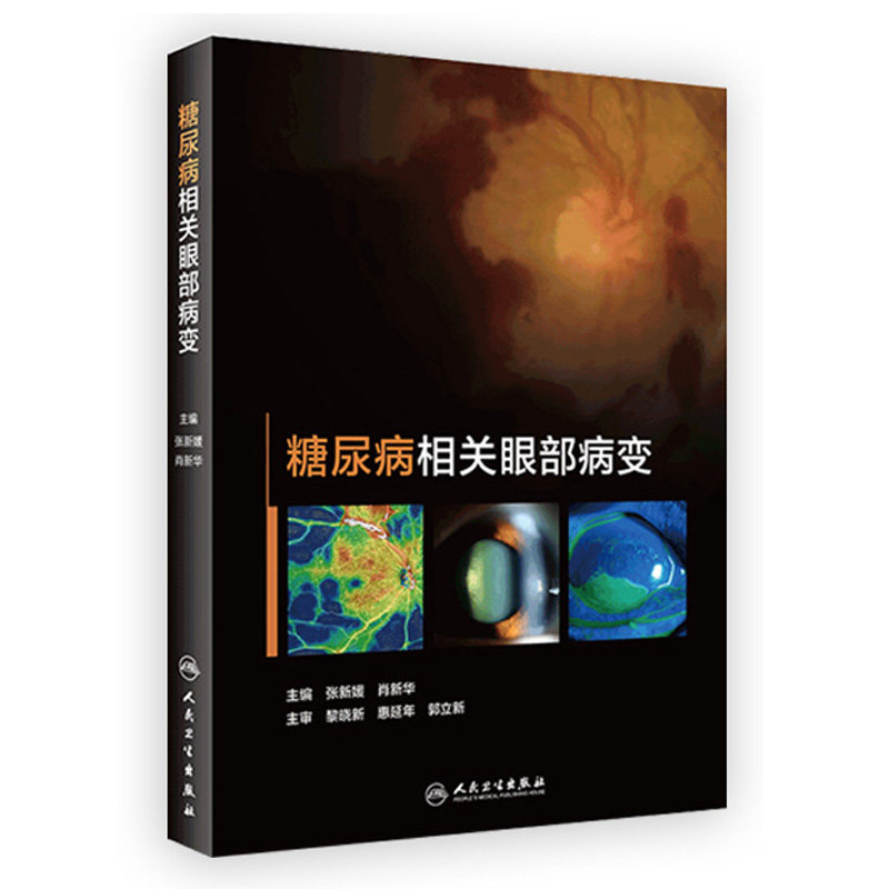 糖尿病相关眼部病变 眼毛细血管视网膜病变黄斑水肿眼表肌白内障眼底病视光视力恢复角膜青光眼人民卫生出版社实用手术眼科书籍