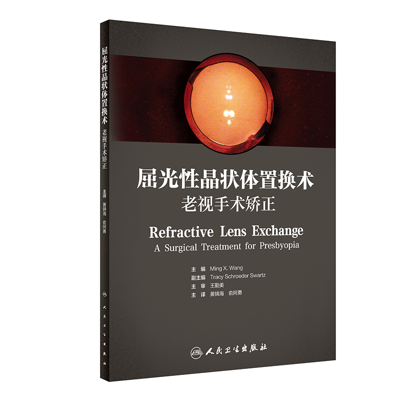 旗舰店屈光性晶状体置换术人卫