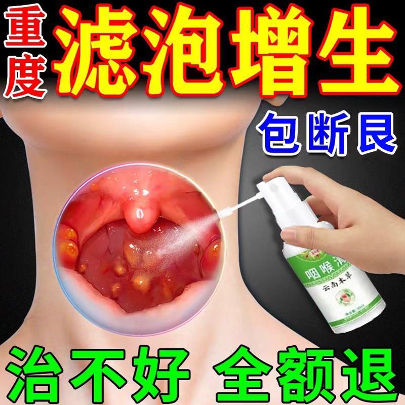咽喉滤泡增生慢性咽炎除裉冶嗓子疼痛灼热干燥异物感滤泡增生喷雾