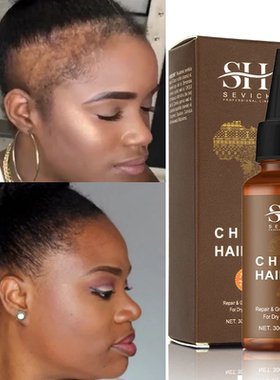 2023 Africa Hair Chebe Oil Crazy Thicken Fast Hair Growing