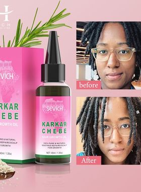 2024 Pure Natural Karkar Oil Set Chebe Hair Growth Oil