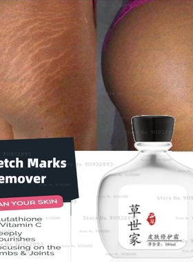 Stretch Marks Reversal Cream, Stretch Marks Remover Cream