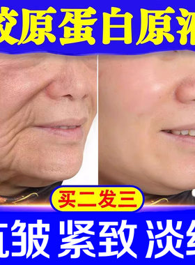 三型胶原蛋白原液去皱纹提拉紧致