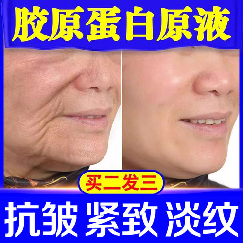 三型胶原蛋白原液去皱纹提拉紧致