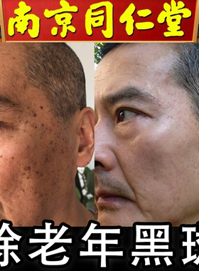 祛斑神器男士专用同仁堂祛斑霜