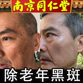 同仁堂祛斑霜男士专用神器正品淡化黑色斑黄褐斑雀老年斑美白祛除