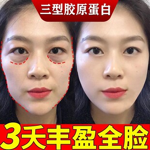 三型胶原面部丰盈精华不回落抗皱紧致去除皱纹法令纹泪沟充实神器
