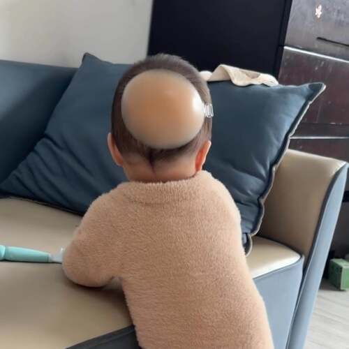 学步防摔神器！防撞头儿童学步走路透气保护垫宝宝防磕头防撞奶盖